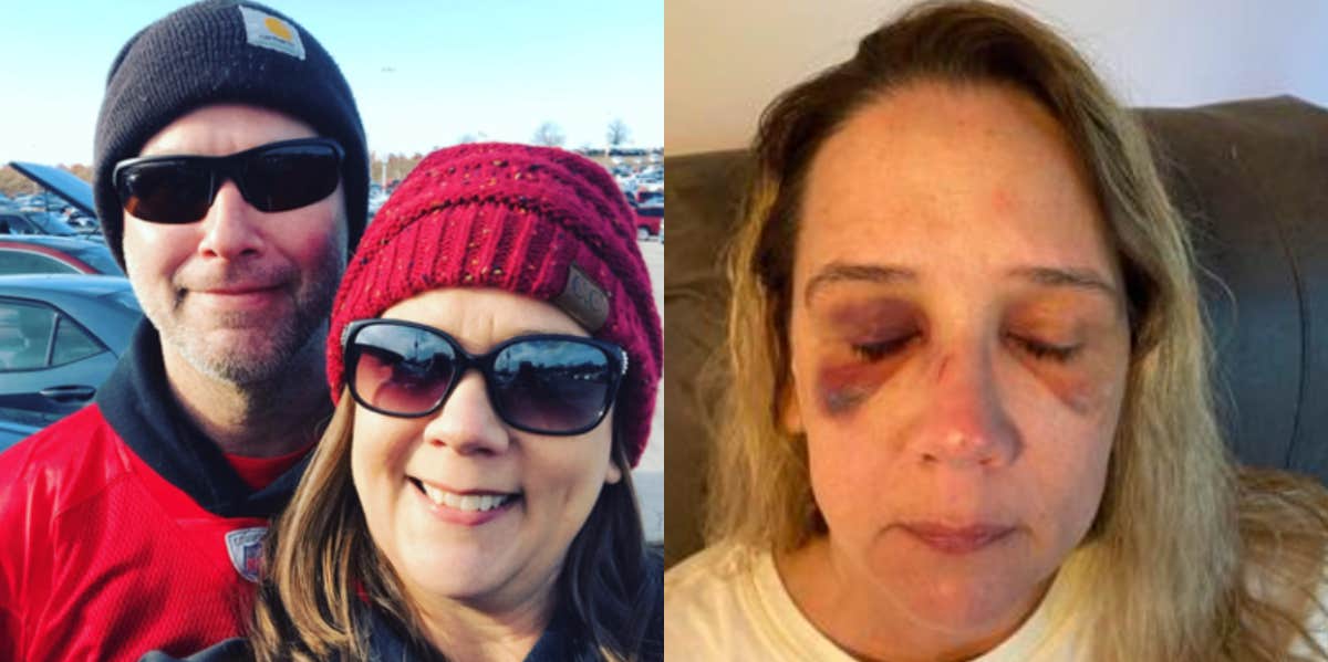 Missouri Mom Beaten After Confronting Teen Bullies Who Wanted To Attack Her Daughter Michelle Audo