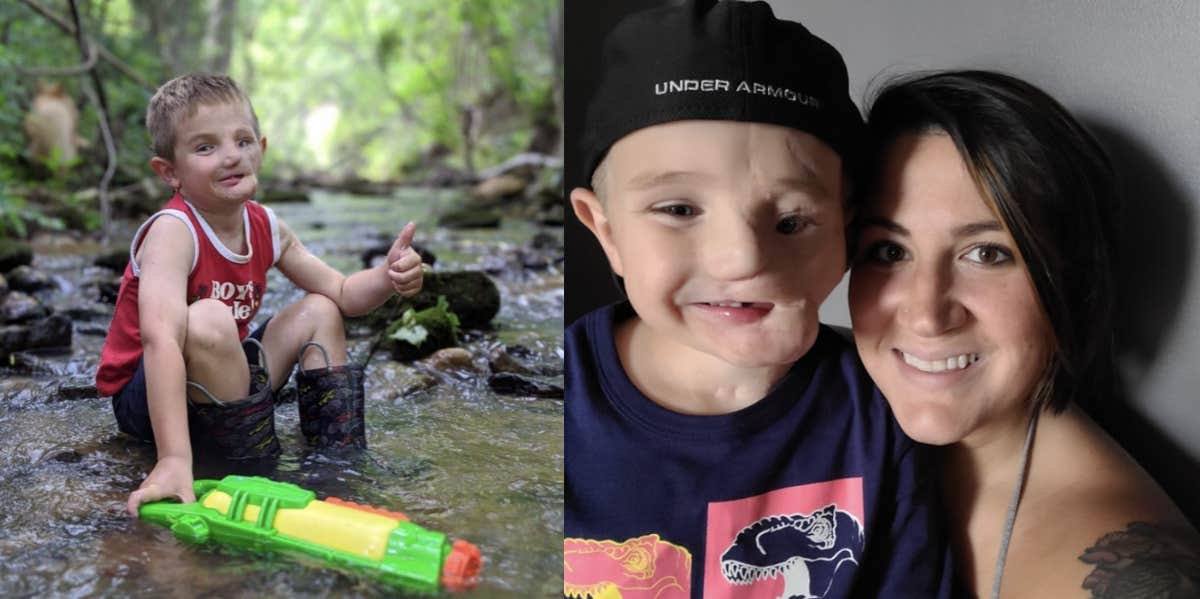 Mom Tells 8-Year-Old Son Who Suffered Permanent Facial Damage In Dog Attack That He's Beautiful Everyday Ryder Wells, Brittany Nicole, dog attack