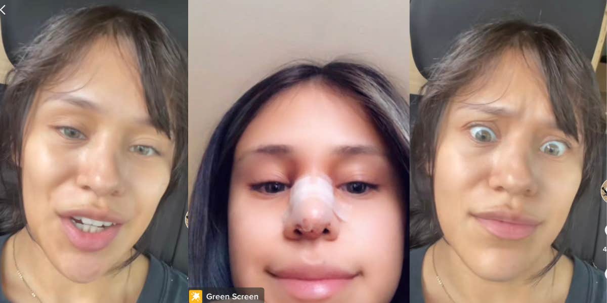 Woman Makes Cheating Boyfriend Pay For Her Nose Job Nose job
