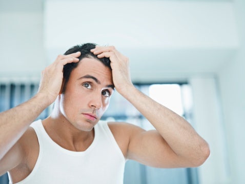 man balding man balding