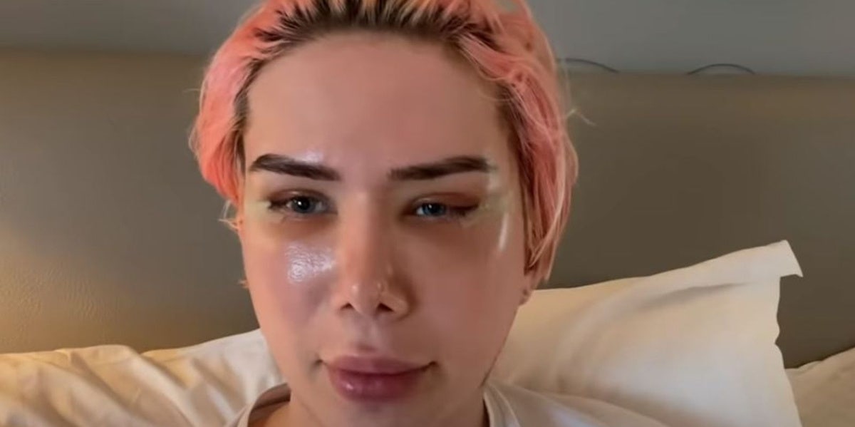 White Influencer Oli London Criticized For 'Identifying As Korean', Receiving Plastic Surgery To Look Like K-Pop Star oli london youtuber