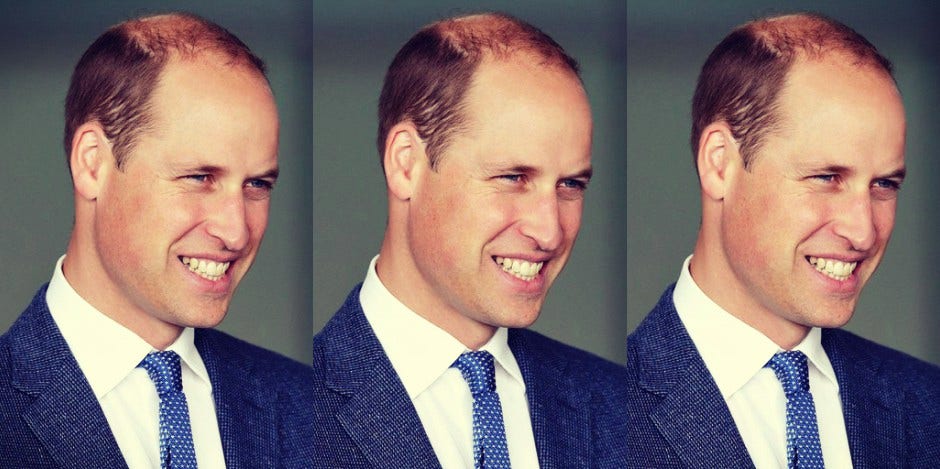 Prince William bald haircut photos
