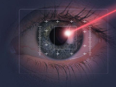 eyeball laser