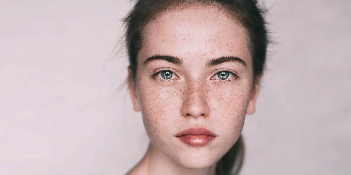 woman with freckles