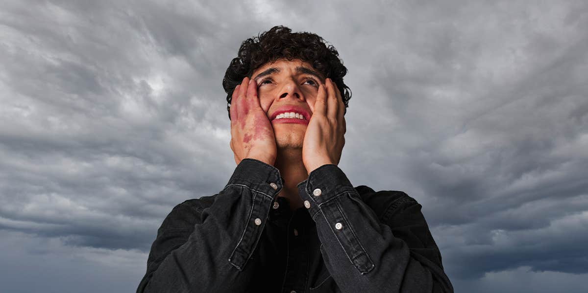 man holding his face 