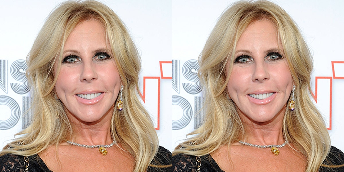 Did Vicki Gunvalson Have Plastic Surgery? Check Out These Before & After Photos