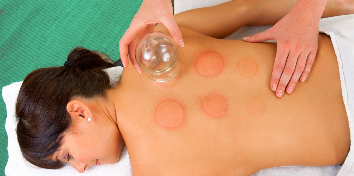 What Is Cupping & What Are The Benefits? + 12 Products To Use At Home What Is Cupping & What Are The Benefits? + 12 Products To Use At Home