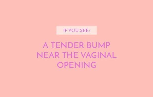 A tender bump near the vaginal opening