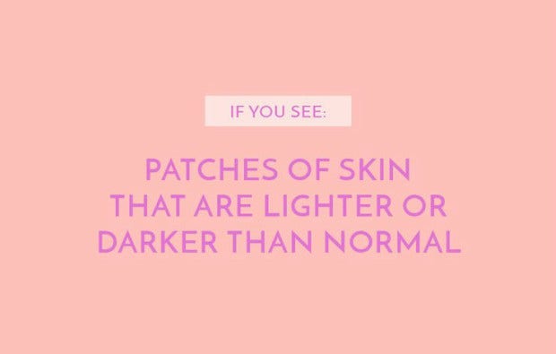 Patches of skin that are lighter or darker than normal