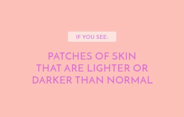 Patches of skin that are lighter or darker than normal