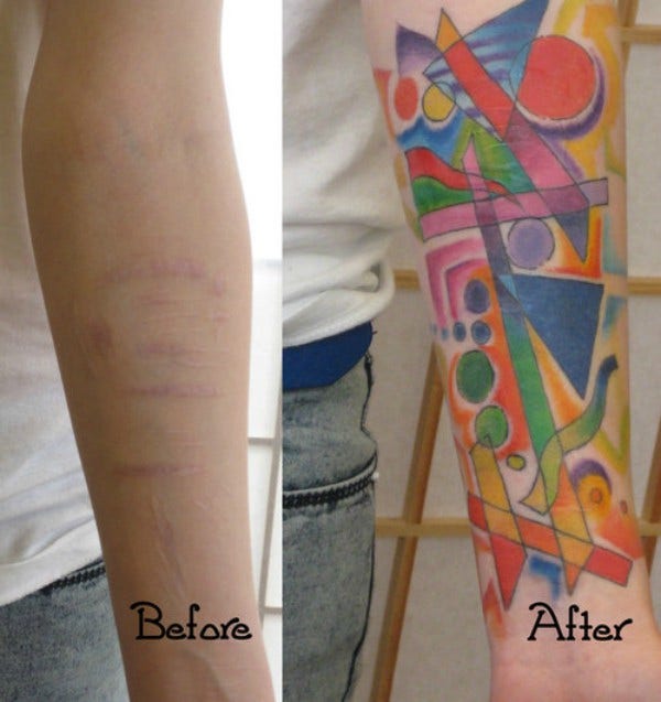 Tattoos That Cover Self-Harm Scars