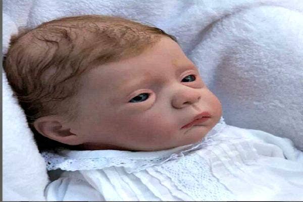 Baby with eyebags.