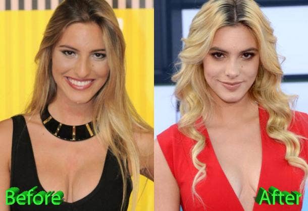 Lele Pons Having Sex - Did Lele Pons Get Plastic Surgery? Before/After Photos And Details About  Her Nose Job | YourTango