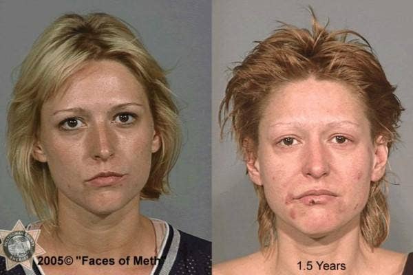 faces of meth