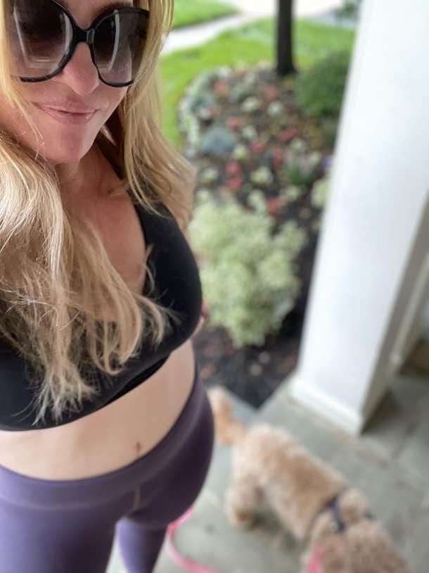 I Created A Body I Love With Plastic Surgery - 14