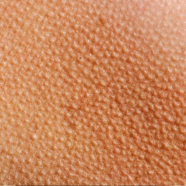 goosebumps up close