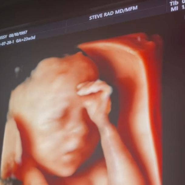 Kylie Jenner Fans Think She Lied About Her Son s Birth Date After Ultrasound Video Clue - 1