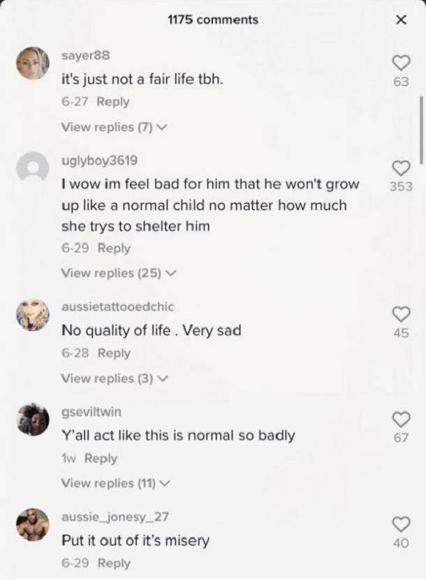 mean TikTok comments about baby with HPE
