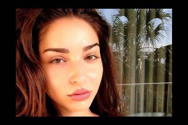 3. Forehead
