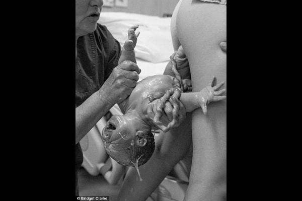 Baby still attached by the placenta.