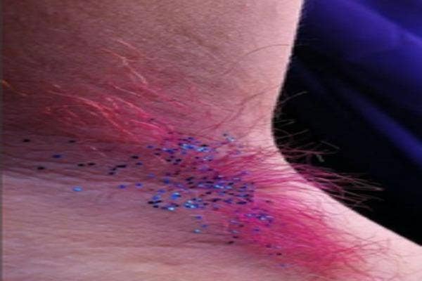 Pink armpit hair with glitter.