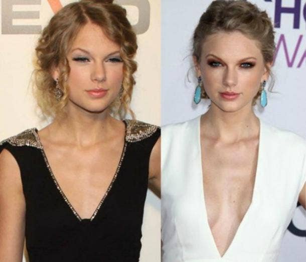 Taylor Swift boob job