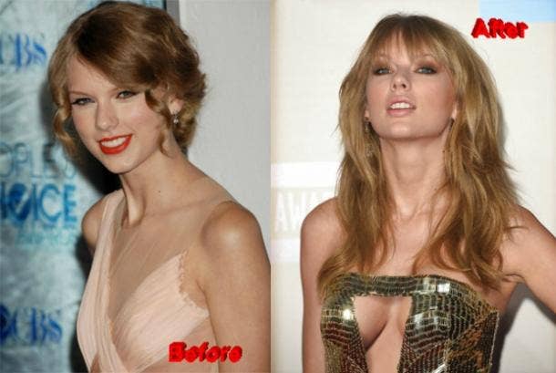 Taylor Swift boob job