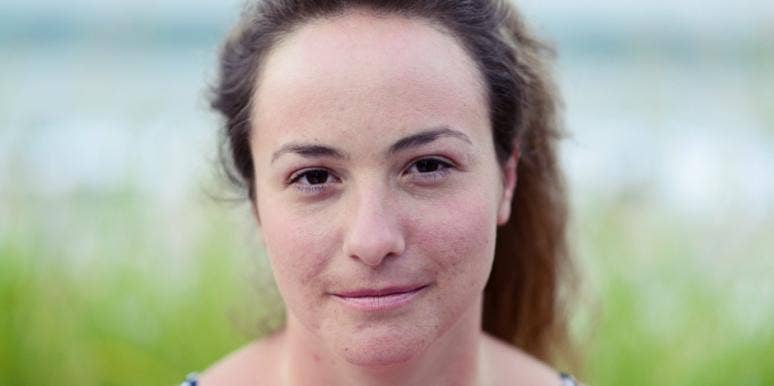 People With Acne Now Live Longer And Look YOUNGER People With Acne Now Live Longer And Look YOUNGER