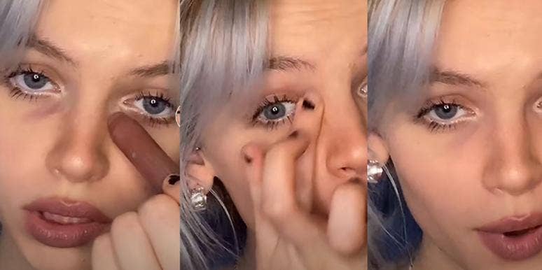 Dark Circles TikTok Dark Circles TikTok