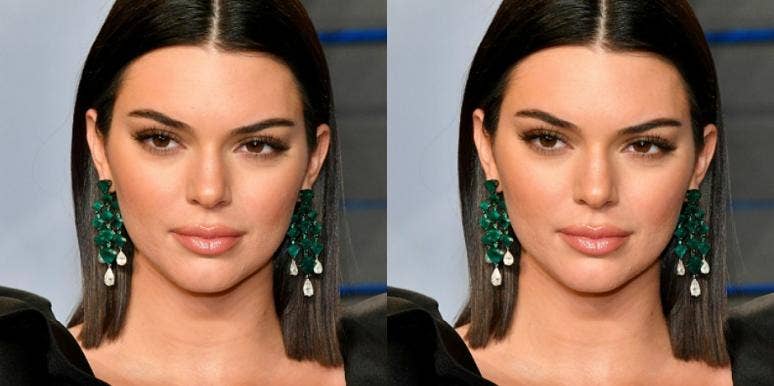 Did Kendall Jenner Have Plastic Surgery A New Instagram