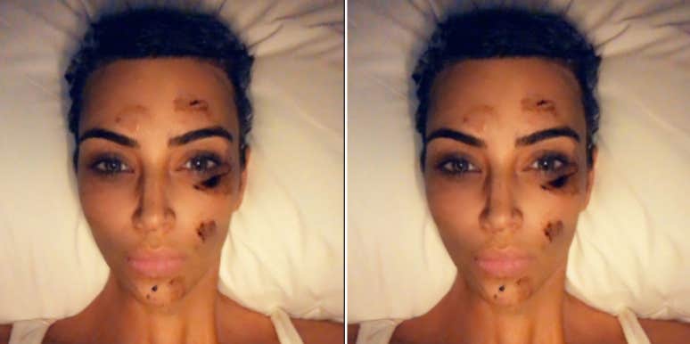 What is Psoriasis? 5 Things To Know About The Skin Condition Kim Kardashian West Has What is Psoriasis? 5 Things To Know About The Skin Condition Kim Kardashian West Has