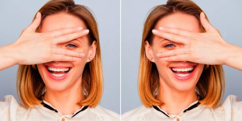 This Woman's Accutane Before/After Photos Are Going Viral For Very Good Reason This Woman's Accutane Before/After Photos Are Going Viral For Very Good Reason
