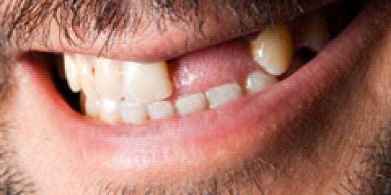 Study Links Erectile Dysfunction To Poor Dental Hygiene Study Links Erectile Dysfunction To Poor Dental Hygiene