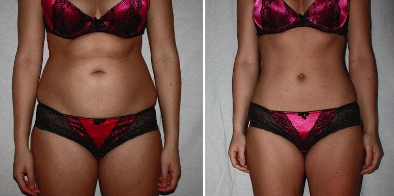 This Image Proves "Before" And "After" Weight Loss Photos Are A Scam before and after weight loss
