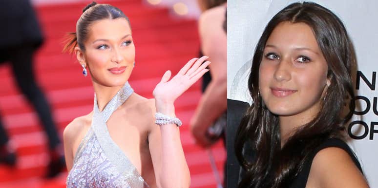 Has Bella Hadid Had Fillers? Doctors Weigh In On Plastic Surgery Claims Bella Hadid