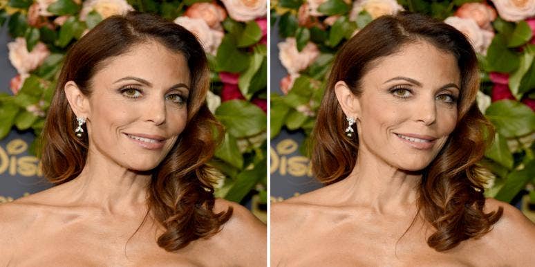 Did Bethenny Frankel Get Plastic Surgery? Before/After Photos And What She's Rumored To Have Gotten Done Did Bethenny Frankel Get Plastic Surgery? Before/After Photos And What She's Rumored To Have Gotten Done
