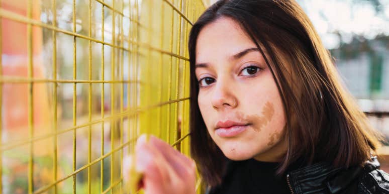 Birthmark Shape Meanings & Spiritual Symbolism woman with birthmark on face