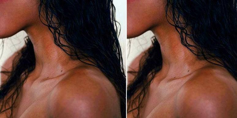 I Hated My Own Body So Much It Almost Killed Me woman pinching skin