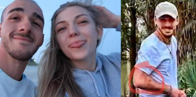 Photos Appear To Show Bruises On Brian Laundrie’s Arm Gabby Petito, Brian Laundrie, Bruising
