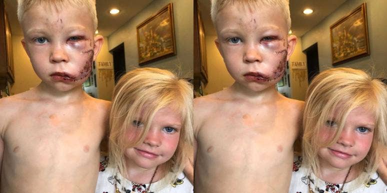 6-Year-Old Boy Hailed As Hero After Saving Sister From Dog Attack 6-Year-Old Boy Hailed As Hero After Saving Sister From Dog Attack