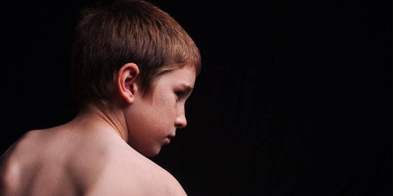 This Bullied 6-Year-Old Got Plastic Surgery To Fix His Prominent "Elf Ears" sad boy