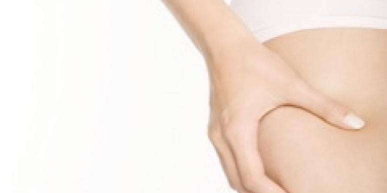 Cellulite: Do Guys Notice It?
