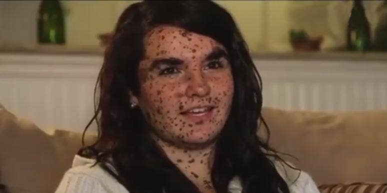 Woman Born With Giant Congenital Melanocytic Nevus Birthmarks Is Our Hero Woman Born With Giant Congenital Melanocytic Nevus Birthmarks Is Our Hero