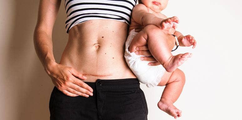 I Was Bullied Into Having A C-Section I Was Bullied Into Having A C-Section
