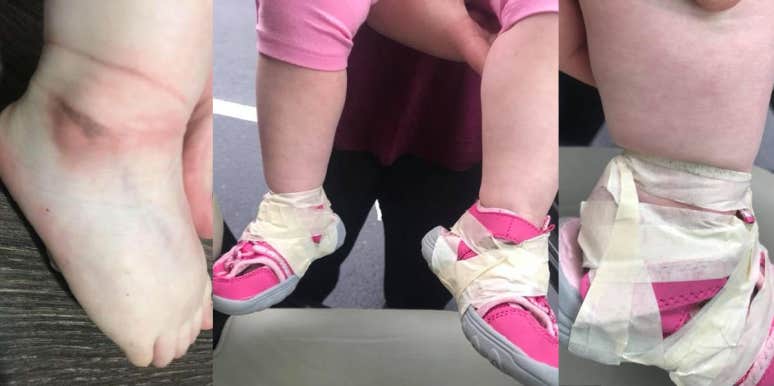 Mom Angered After Discovering Marks On Her Daughter's Ankles After Daycare Staff Taped Her Shoes On Jessica Hayes' daughter's shoes taped by daycare workers
