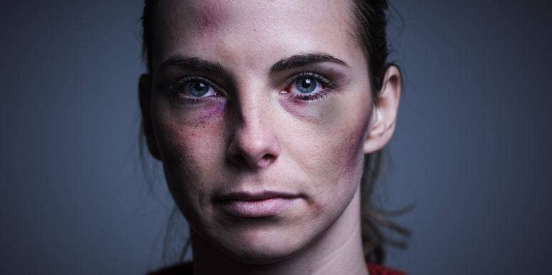 My Ex-Husband Is What Happened To My Face (You Can Stop Staring) My Ex-Husband Is What Happened To My Face (You Can Stop Staring)