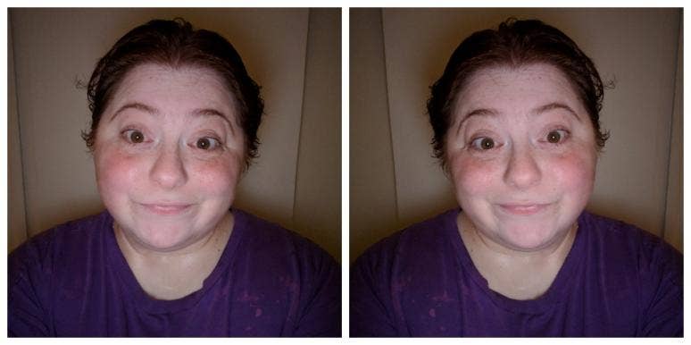 fat obese woman fat obese woman