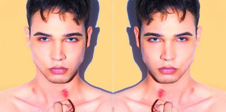 Are Hickeys Dangerous? Are Hickeys Dangerous?
