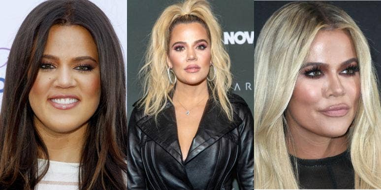 Khloe Kardashian before and after alleged plastic surgery