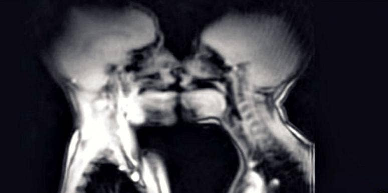 mri mri